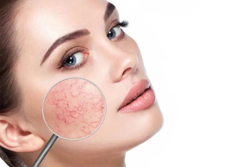 DA MỎNG THÌ NÊN SỬ DỤNG MỸ PHẨM GÌ ĐỂ HỒI PHỤC LÀN DA KHỎE HƠN?